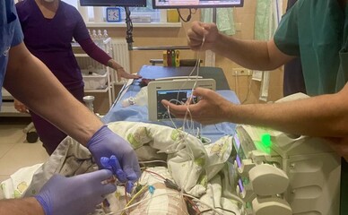 Одеські кардіохірурги провели унікальну операцію немовляті з вродженою вадою серця
